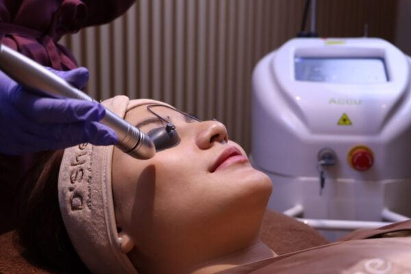 LASER ACCU TONING