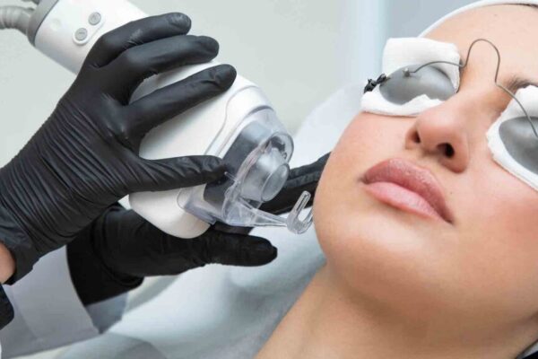 LASER FRACTIONAL CO2 DERMA+ FACE